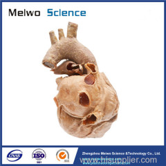 Cardiovascular plastianted specimen for medical anatomy teaching