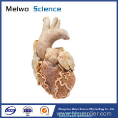 Cardiovascular plastianted specimen for medical anatomy teaching