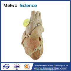 Heart with coronary vessels plastinated specimen for sale