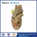 Heart with coronary vessels plastinated specimen for sale