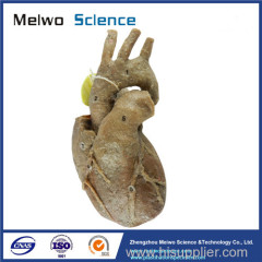 Heart with coronary vessels plastinated specimen for sale