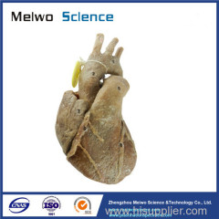 Heart with coronary vessels plastinated specimen for sale