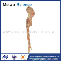 Brachial plexus and its branches plastinated specimen