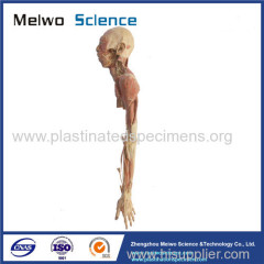 Brachial plexus and its branches plastinated specimen