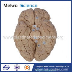 The horizontal section of brain plastinated specimen