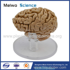 Human pituitary and pineal gland plastinated specimen