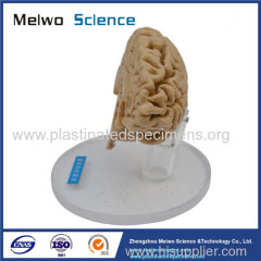 Human pituitary and pineal gland plastinated specimen