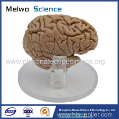 Human pituitary and pineal gland plastinated specimen