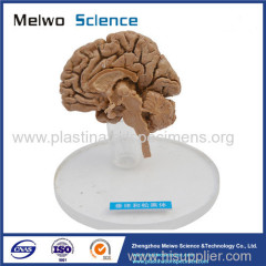 Human pituitary and pineal gland plastinated specimen