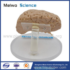 Artery of cerebral hemisphere plastinated specimen