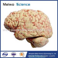 Cerebral hemisphere and brain stem plastinated specimen