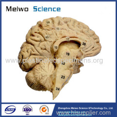 Cerebral hemisphere and brain stem plastinated specimen