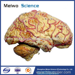 Cerebral hemisphere and brain stem plastinated specimen