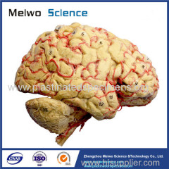 Cerebral hemisphere and brain stem plastinated specimen