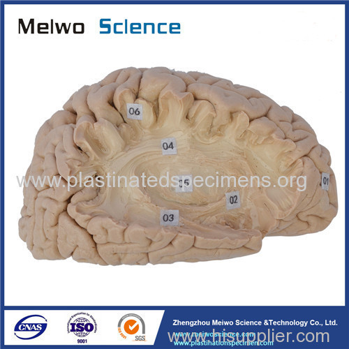 Human association fiber of cerebral hemisphere plastination