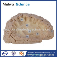 Human association fiber of cerebral hemisphere plastination