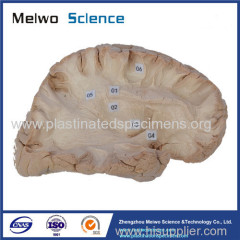 Human association fiber of cerebral hemisphere plastination