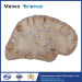 Human association fiber of cerebral hemisphere plastination