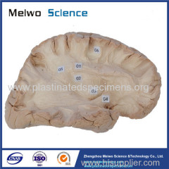 Human association fiber of cerebral hemisphere plastination