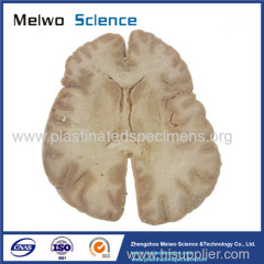 Horizontal section of brain through inner capsule plastinated specimen