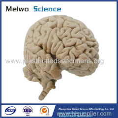 Human median sagittal section of brain plastinated specimen