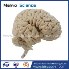 Human median sagittal section of brain plastinated specimen