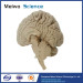 Human median sagittal section of brain plastinated specimen