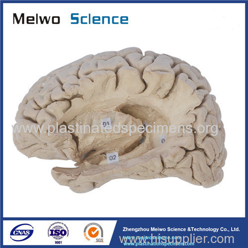 Hippocampal formation plastination for medical university