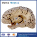 Hippocampal formation plastination for medical university