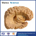 Hippocampal formation plastination for medical university