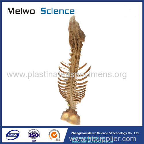 Spinal cord with nerves in vertebral column medical specimen plastination