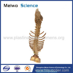 Spinal cord with nerves in vertebral column medical specimen plastination