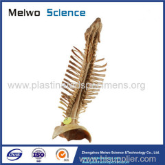 Spinal cord with nerves in vertebral column medical specimen plastination