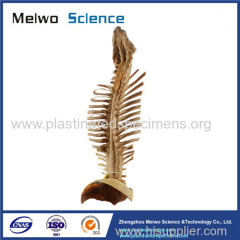 Spinal cord with nerves in vertebral column medical specimen plastination