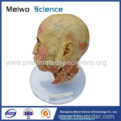 Facial nerve plastinated specimen