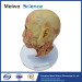 Facial nerve plastinated specimen