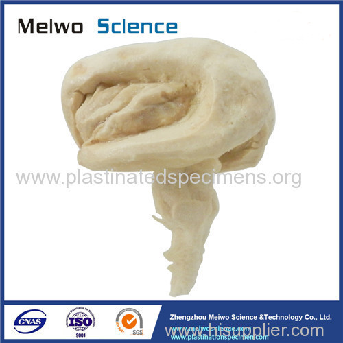 Brain stem plastinated specimen
