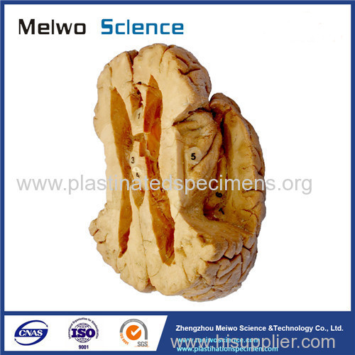 Ventricle and the insula plastinated specimen