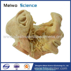 Human trigeminal nerve plastinated specimen