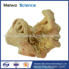 Human trigeminal nerve plastinated specimen