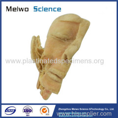 Human trigeminal nerve plastinated specimen