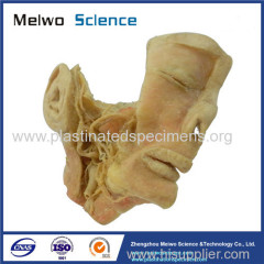 Human trigeminal nerve plastinated specimen