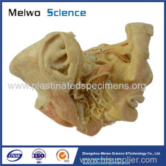 Human trigeminal nerve plastinated specimen