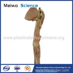 Deep vascular nerve of upper limb plastinated specimen