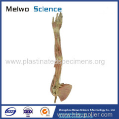 Deep vascular nerve of upper limb plastinated specimen