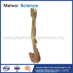 Deep vascular nerve of upper limb plastinated specimen