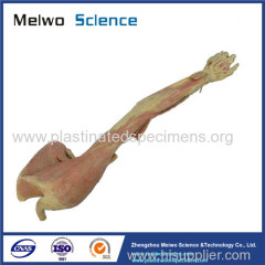 Deep vascular nerve of upper limb plastinated specimen