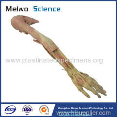 Deep vascular nerve of upper limb plastinated specimen