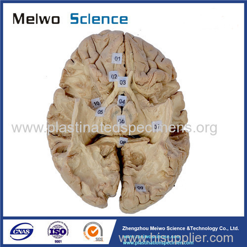 Tractus opticus and optic radiation plastinated specimen