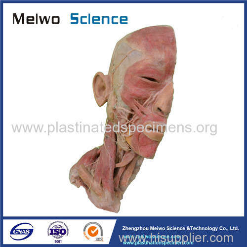 Superficial vascular nerve of head and neck medical specimen plastination